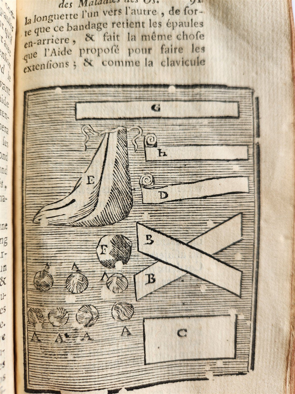1775 Treatise on Diseases of Bones ILLUSTRATED MEDICAL DEVICES antique 2 VOLS