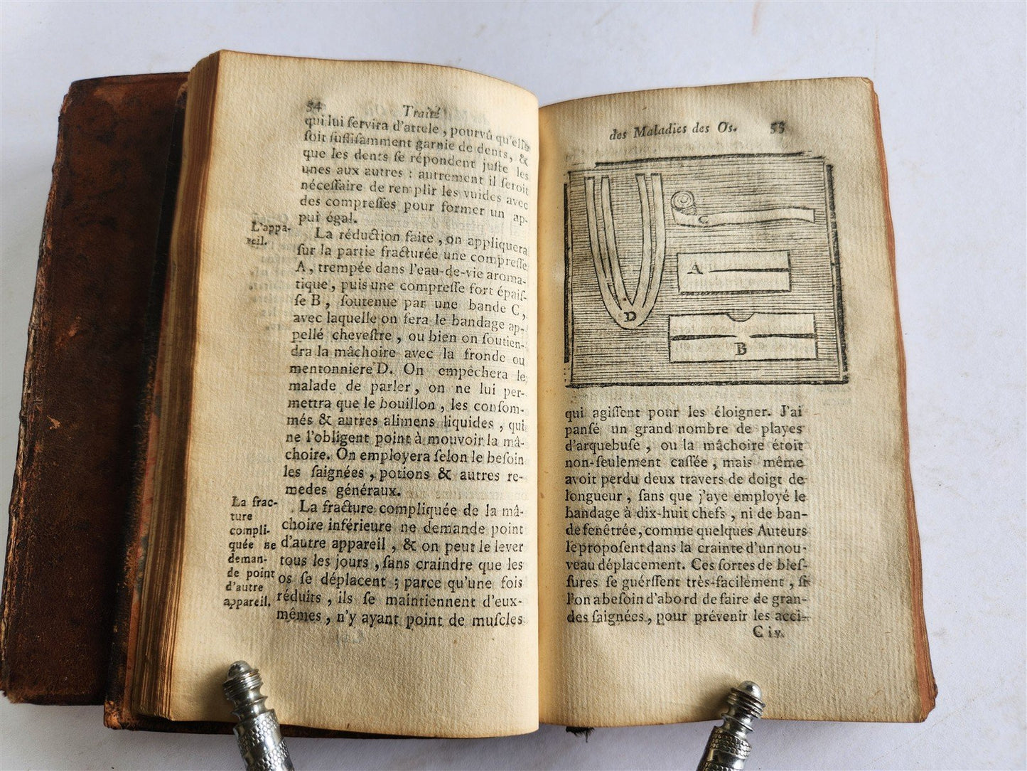 1775 Treatise on Diseases of Bones ILLUSTRATED MEDICAL DEVICES antique 2 VOLS