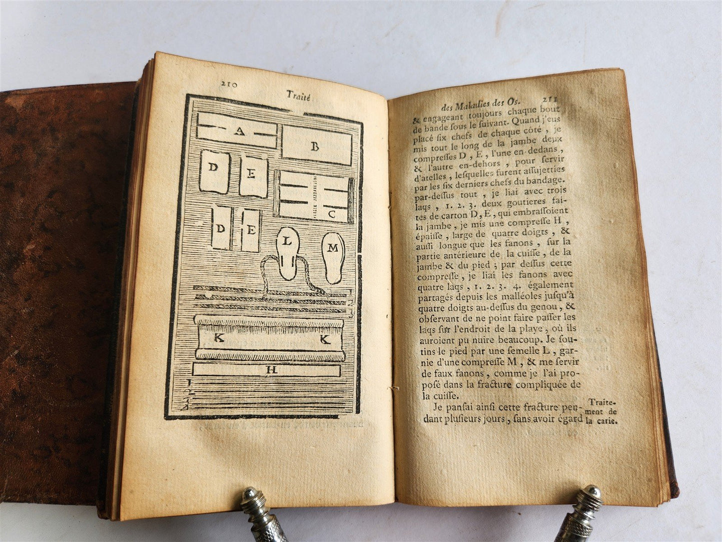1775 Treatise on Diseases of Bones ILLUSTRATED MEDICAL DEVICES antique 2 VOLS