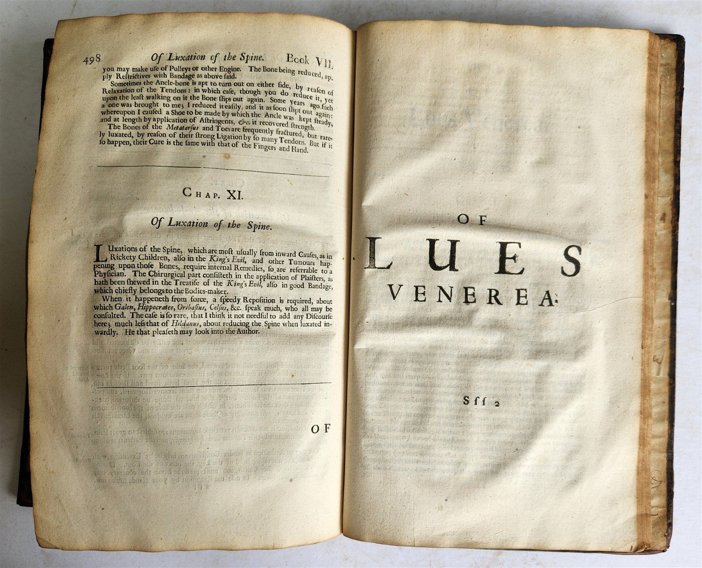 1692 SEVERAL CHIRURGICAL TREATISES by Richard Wiseman in ENGLISH ANTIQUE FOLIO
