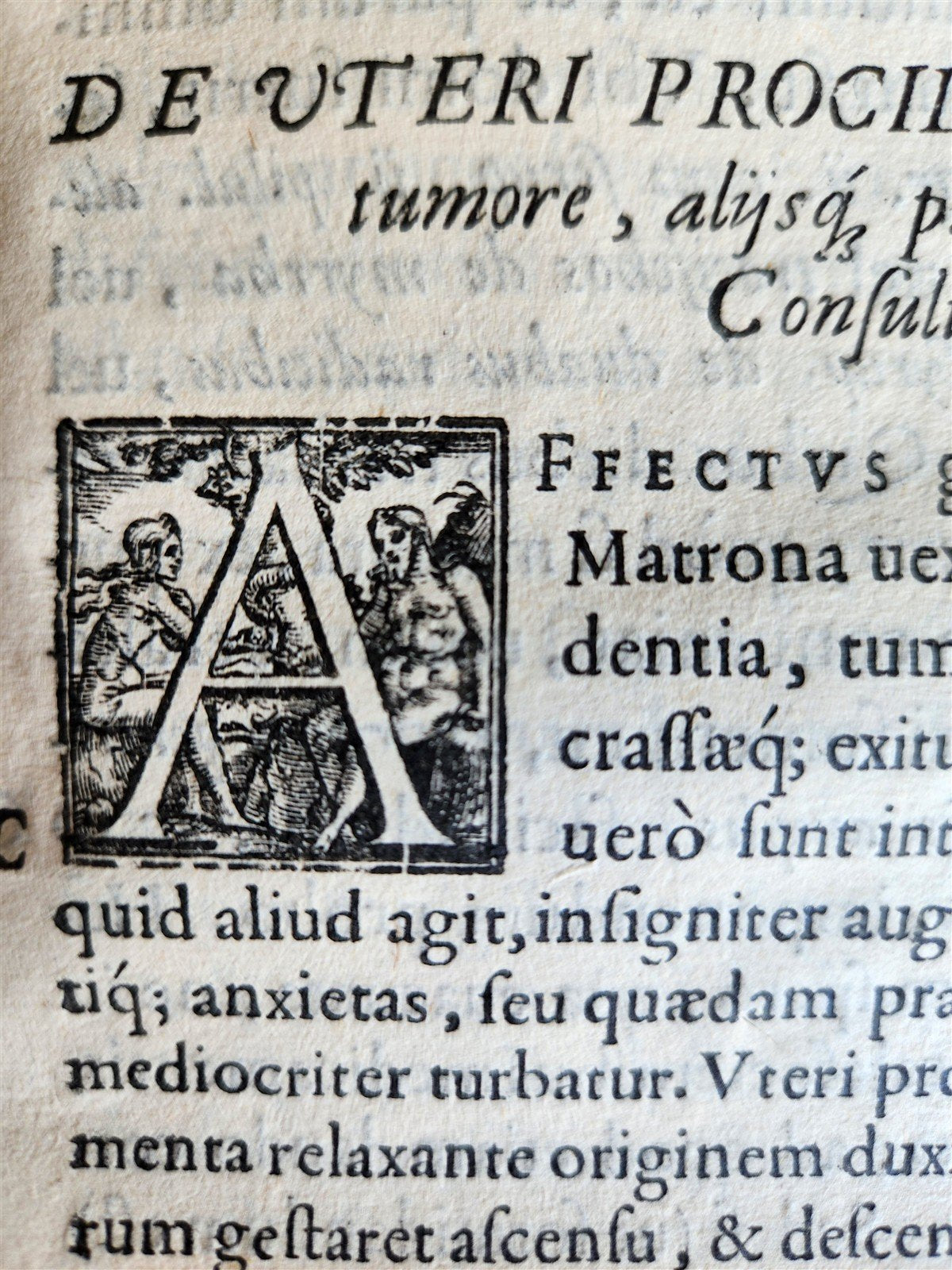 1587-1597 MEDICAL TREATISE by HIERONYMI MERCURIALIS antique 16th CENTURY FOLIO