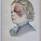 1885 ELEPHANTIASIS antique ILLUSTRATED FOLIO in GERMAN by Esmarch & Kulenkampff