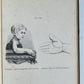 1885 ELEPHANTIASIS antique ILLUSTRATED FOLIO in GERMAN by Esmarch & Kulenkampff