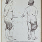 1885 ELEPHANTIASIS antique ILLUSTRATED FOLIO in GERMAN by Esmarch & Kulenkampff