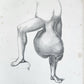 1885 ELEPHANTIASIS antique ILLUSTRATED FOLIO in GERMAN by Esmarch & Kulenkampff