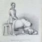 1885 ELEPHANTIASIS antique ILLUSTRATED FOLIO in GERMAN by Esmarch & Kulenkampff