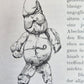 1885 ELEPHANTIASIS antique ILLUSTRATED FOLIO in GERMAN by Esmarch & Kulenkampff