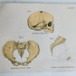 1924 OBSTETRICAL CHARTS in COLORS antique