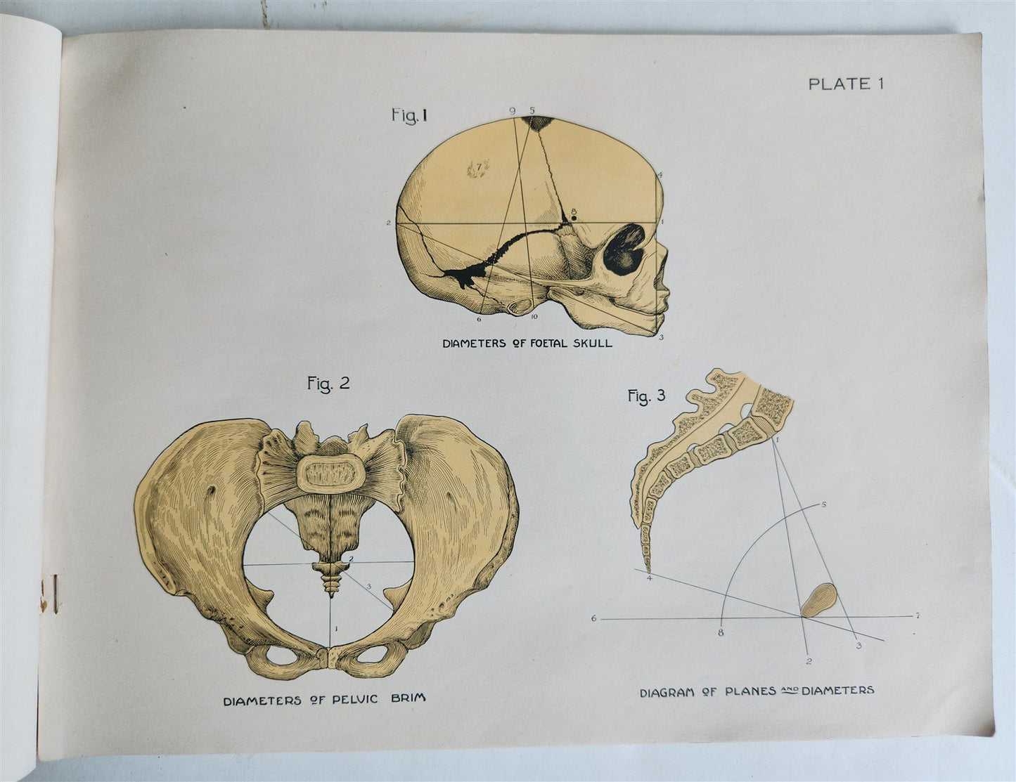 1924 OBSTETRICAL CHARTS in COLORS antique