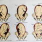 1924 OBSTETRICAL CHARTS in COLORS antique
