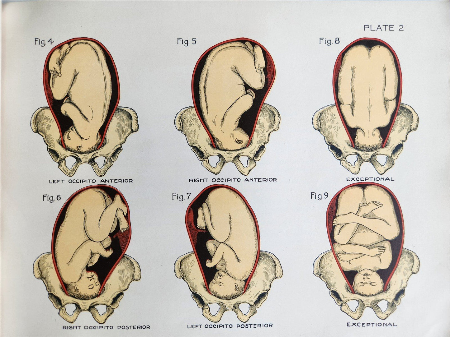 1924 OBSTETRICAL CHARTS in COLORS antique