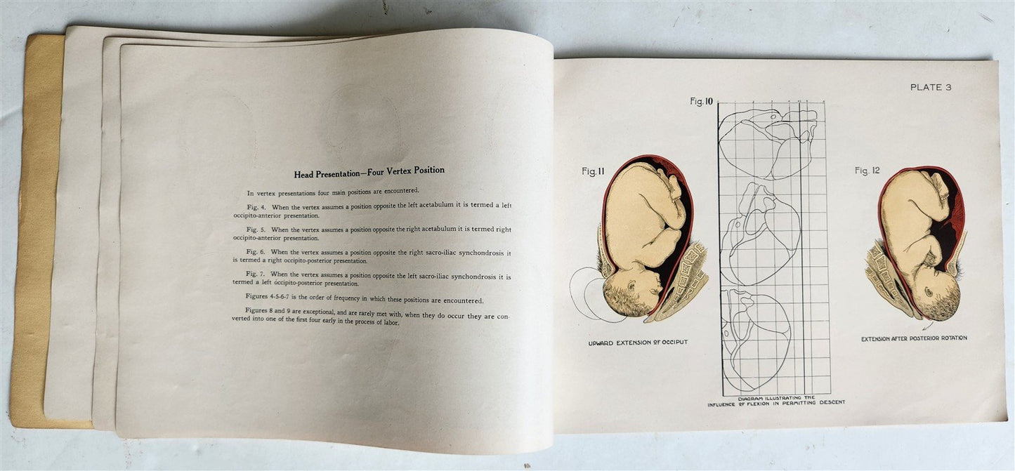 1924 OBSTETRICAL CHARTS in COLORS antique