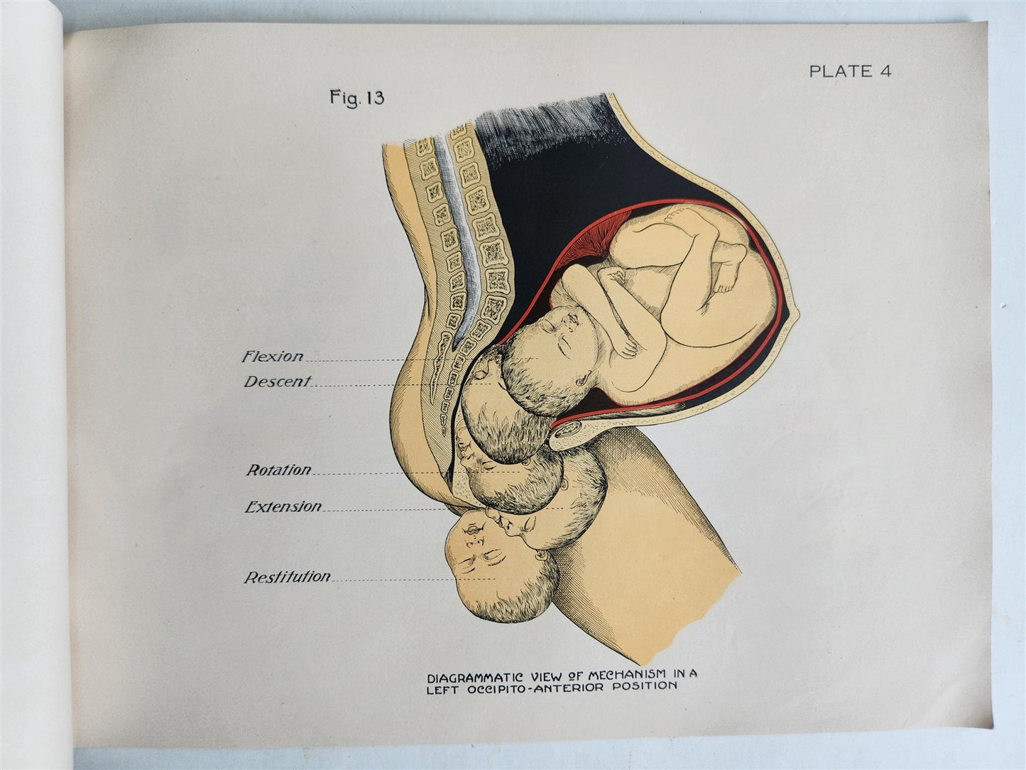 1924 OBSTETRICAL CHARTS in COLORS antique