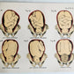 1924 OBSTETRICAL CHARTS in COLORS antique
