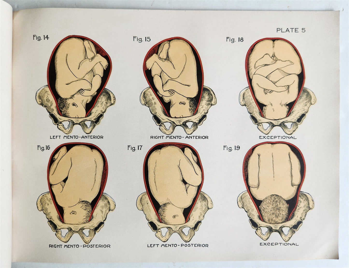 1924 OBSTETRICAL CHARTS in COLORS antique