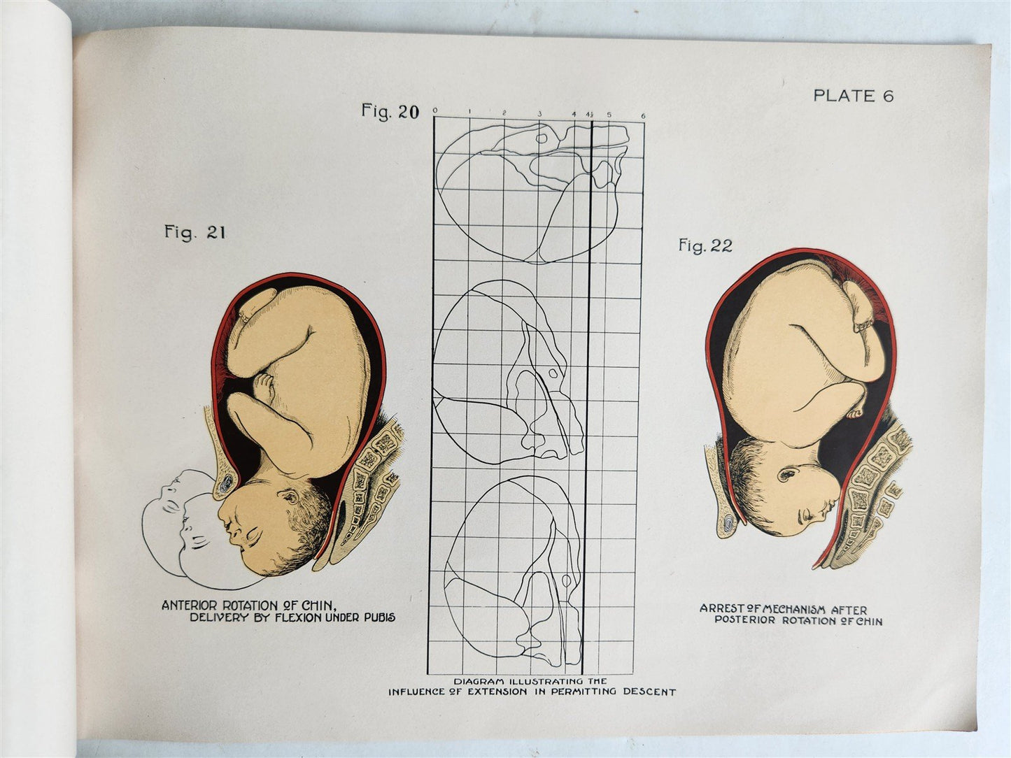 1924 OBSTETRICAL CHARTS in COLORS antique