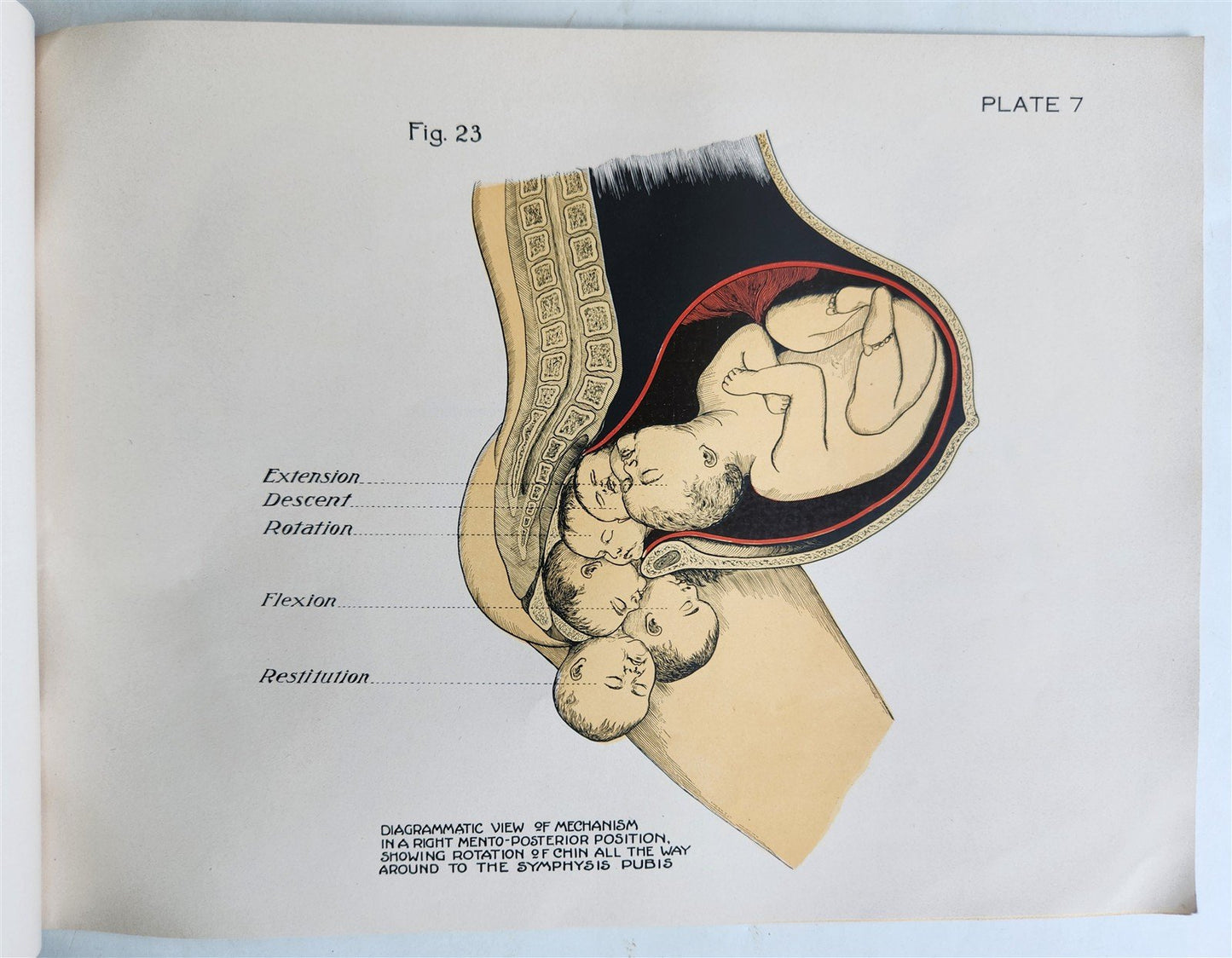1924 OBSTETRICAL CHARTS in COLORS antique