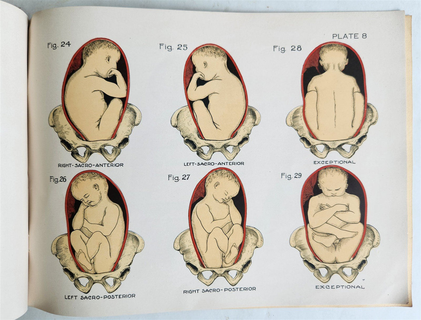 1924 OBSTETRICAL CHARTS in COLORS antique