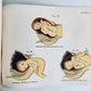 1924 OBSTETRICAL CHARTS in COLORS antique