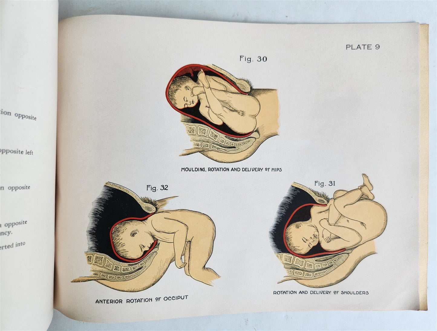 1924 OBSTETRICAL CHARTS in COLORS antique