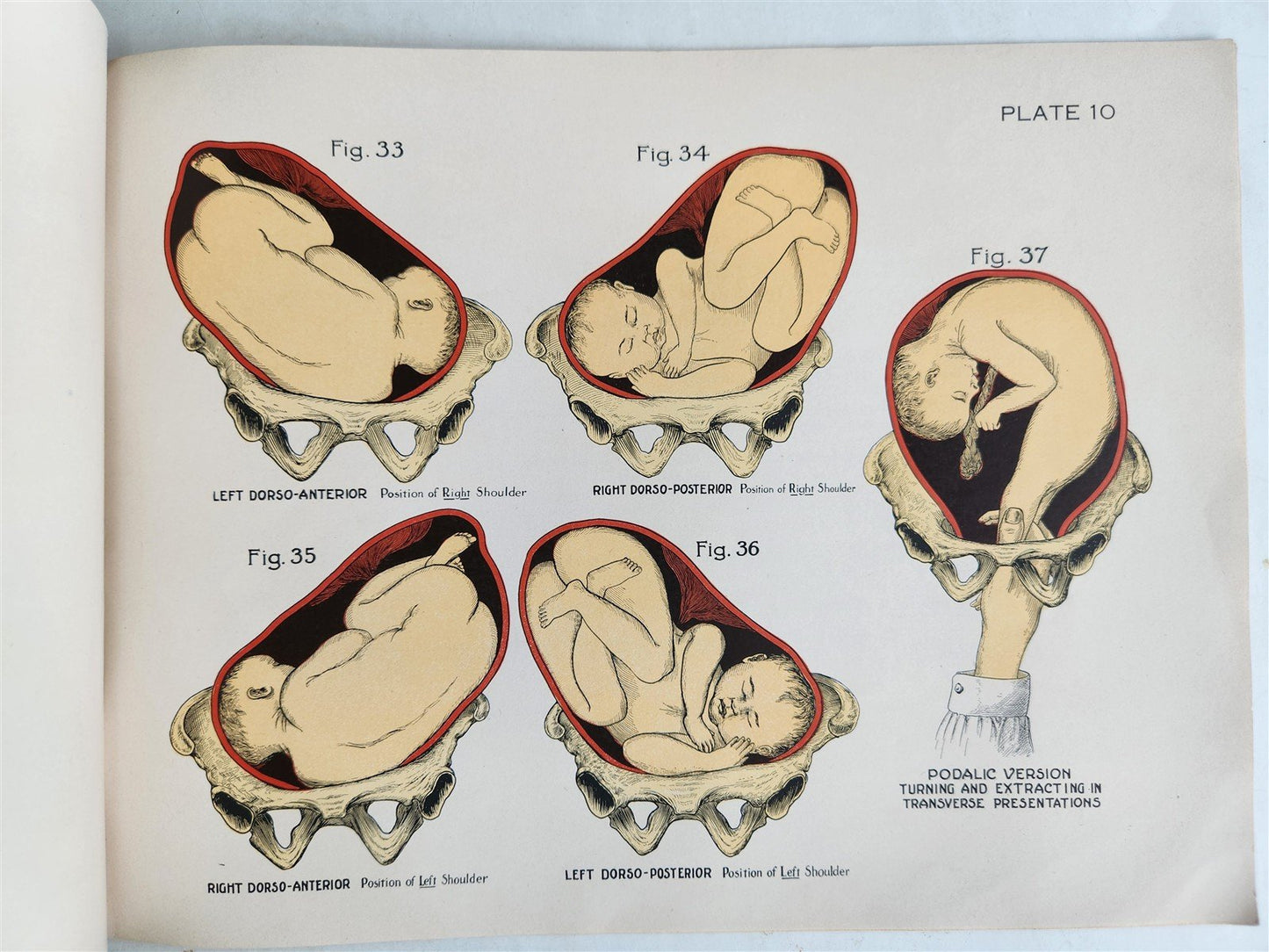 1924 OBSTETRICAL CHARTS in COLORS antique