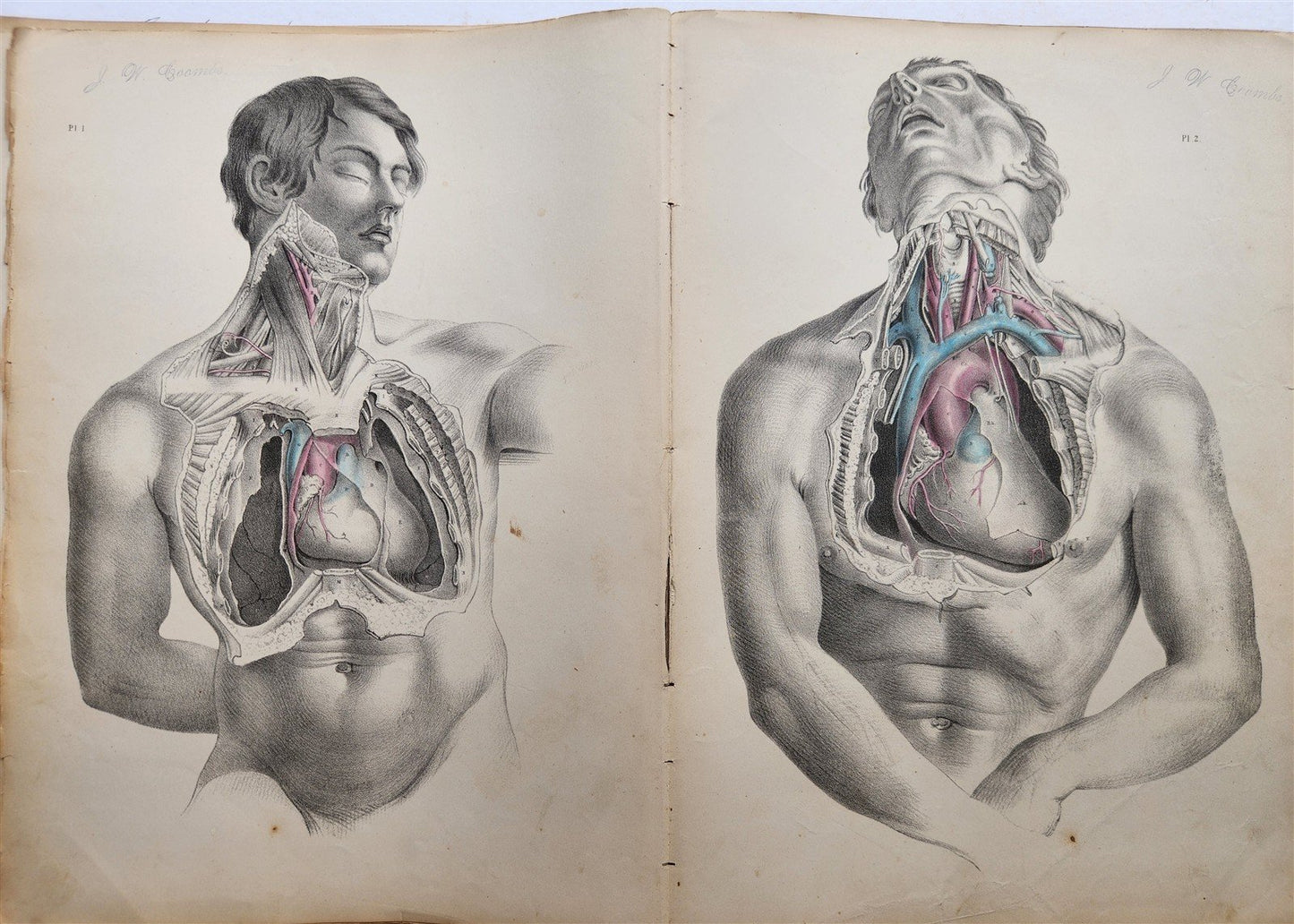 1860s SURGICAL ANATOMY by Joseph Maclise antique ILLUSTRATED w/ 68 plates