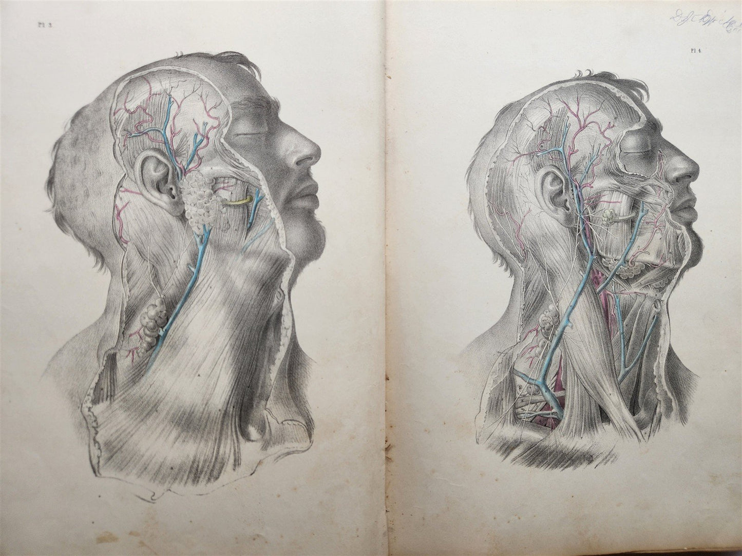 1860s SURGICAL ANATOMY by Joseph Maclise antique ILLUSTRATED w/ 68 plates
