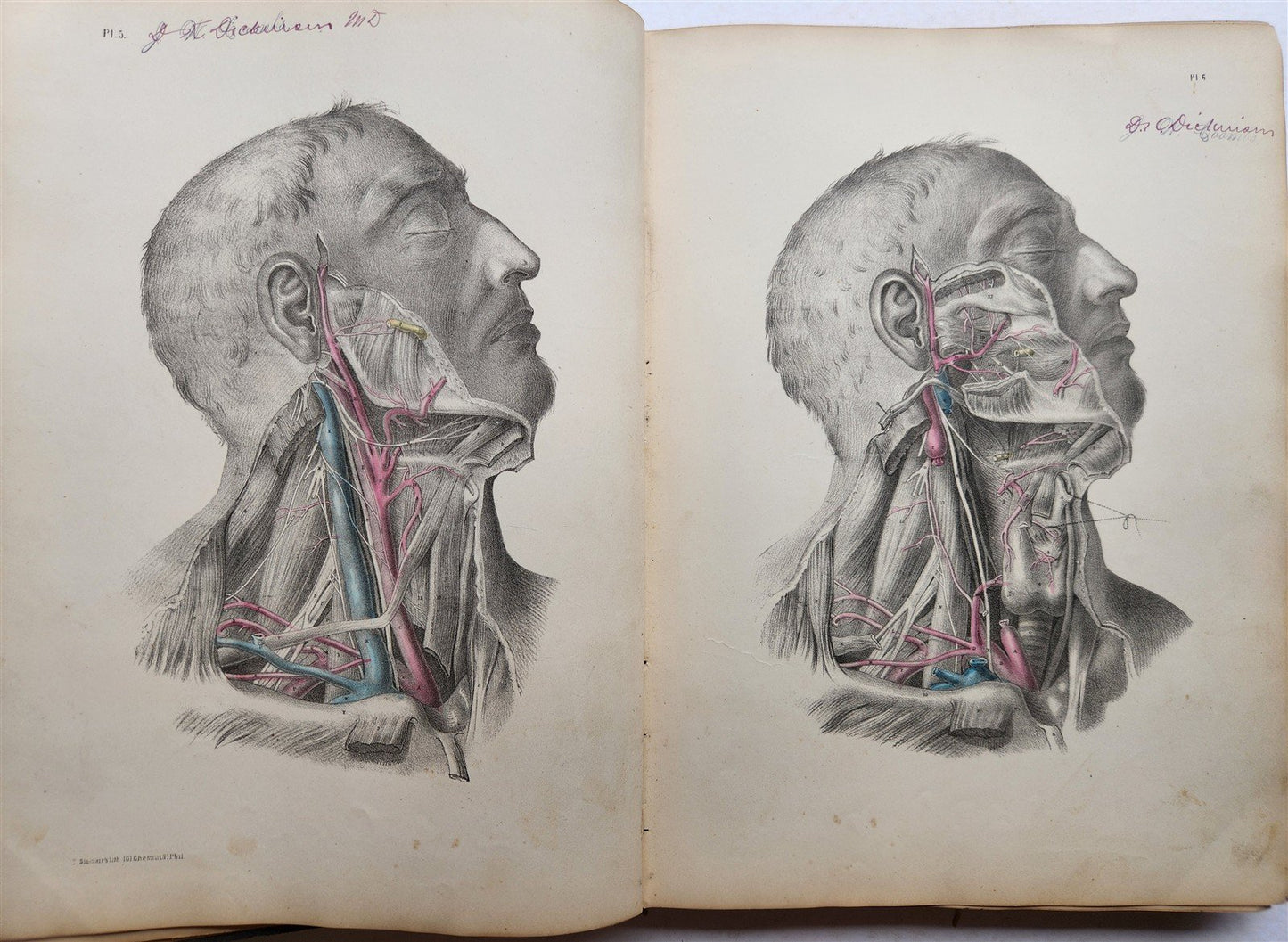 1860s SURGICAL ANATOMY by Joseph Maclise antique ILLUSTRATED w/ 68 plates