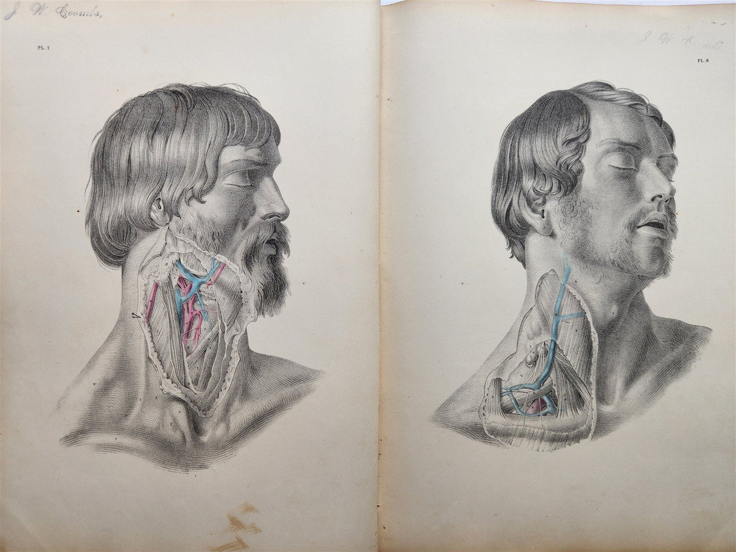 1860s SURGICAL ANATOMY by Joseph Maclise antique ILLUSTRATED w/ 68 plates