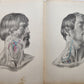 1860s SURGICAL ANATOMY by Joseph Maclise antique ILLUSTRATED w/ 68 plates