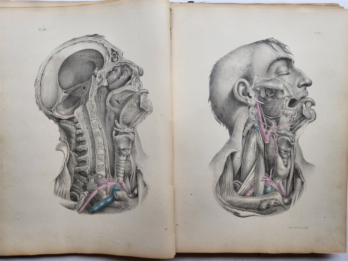 1860s SURGICAL ANATOMY by Joseph Maclise antique ILLUSTRATED w/ 68 plates