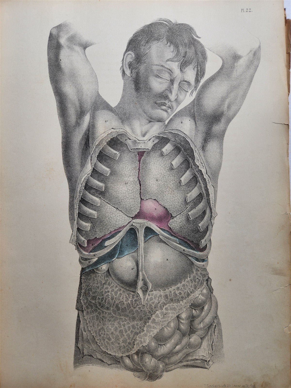 1860s SURGICAL ANATOMY by Joseph Maclise antique ILLUSTRATED w/ 68 plates
