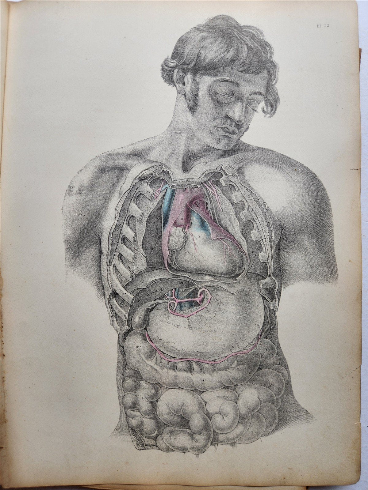 1860s SURGICAL ANATOMY by Joseph Maclise antique ILLUSTRATED w/ 68 plates