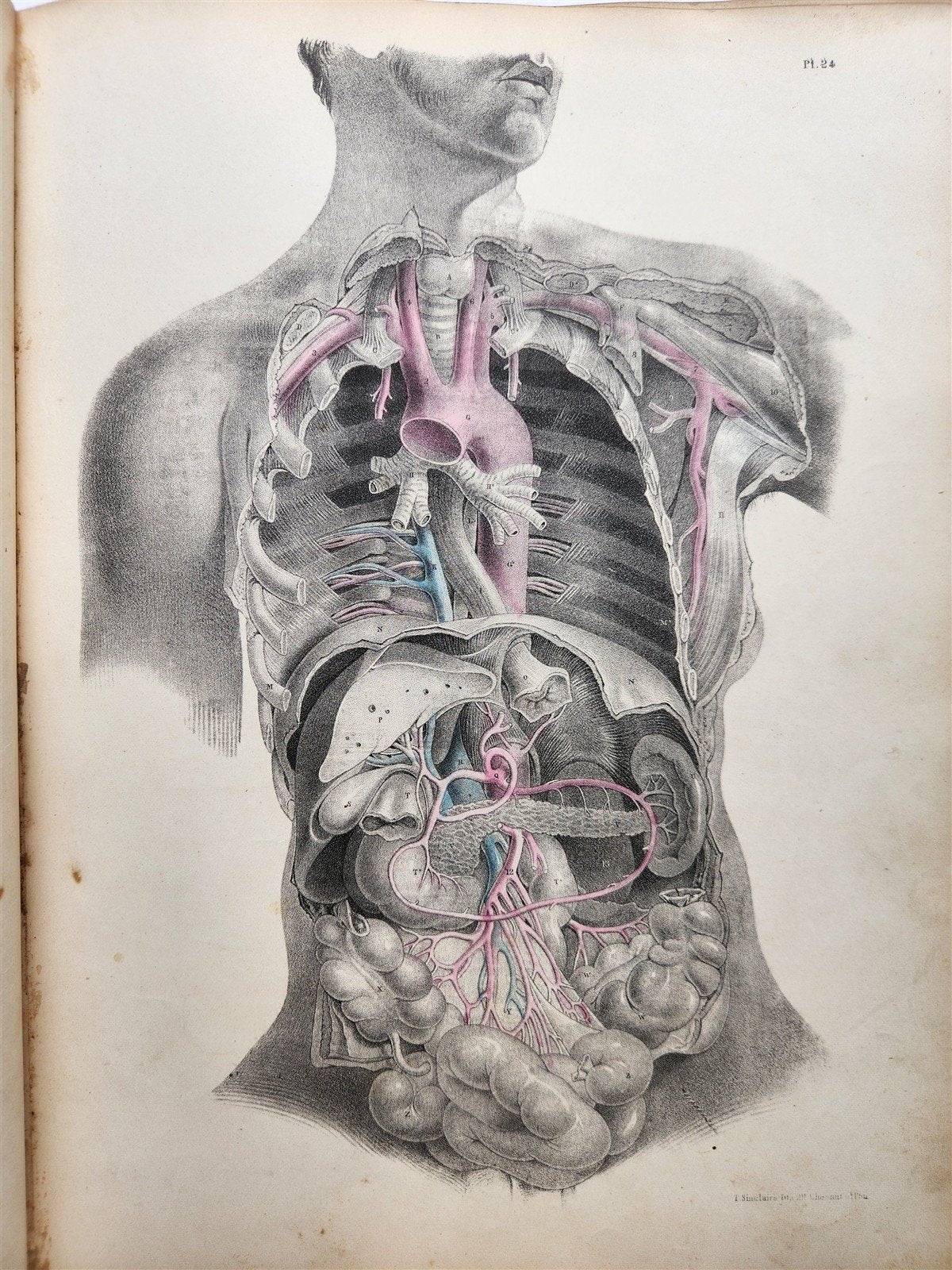 1860s SURGICAL ANATOMY by Joseph Maclise antique ILLUSTRATED w/ 68 plates