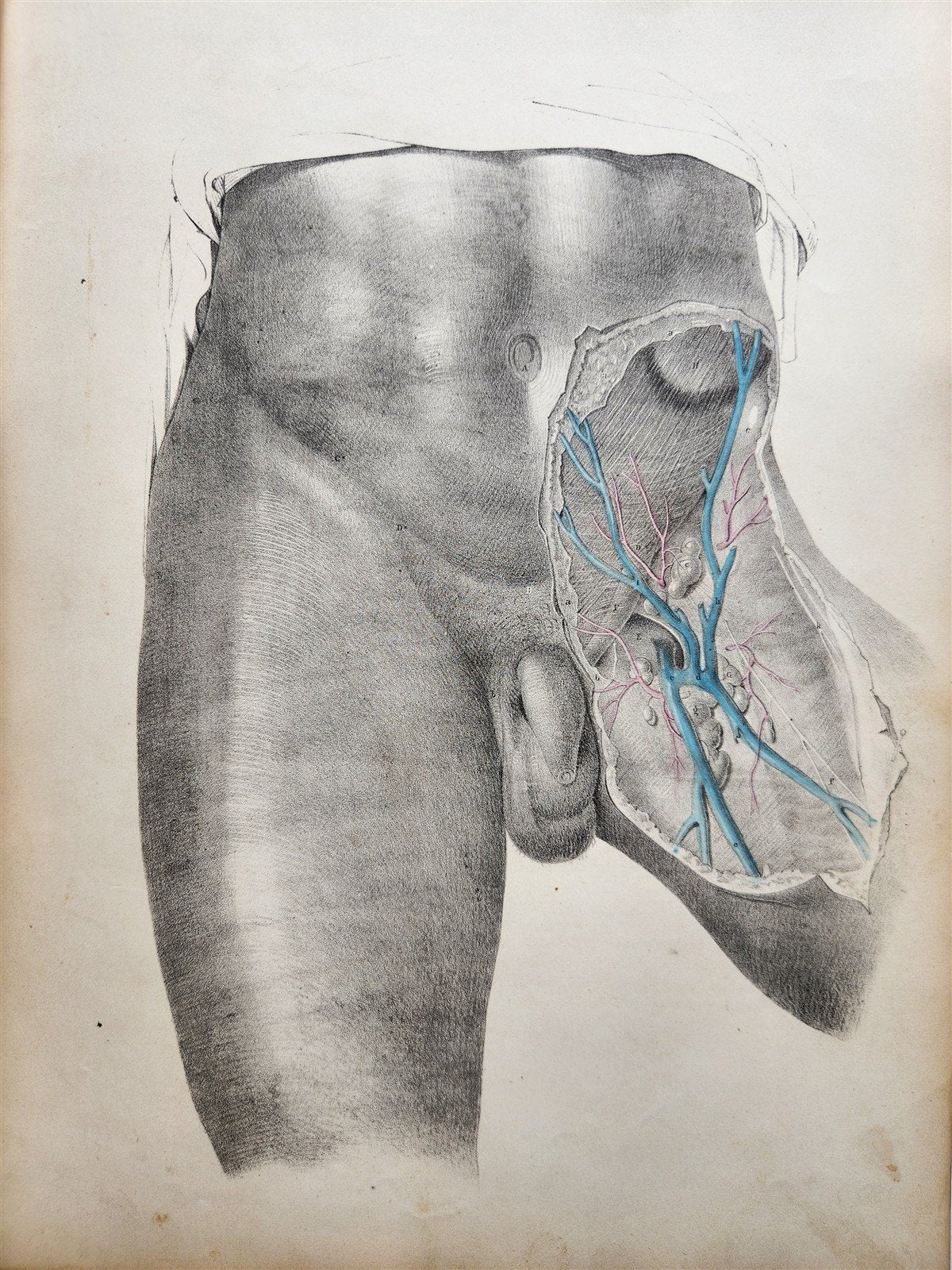 1860s SURGICAL ANATOMY by Joseph Maclise antique ILLUSTRATED w/ 68 plates