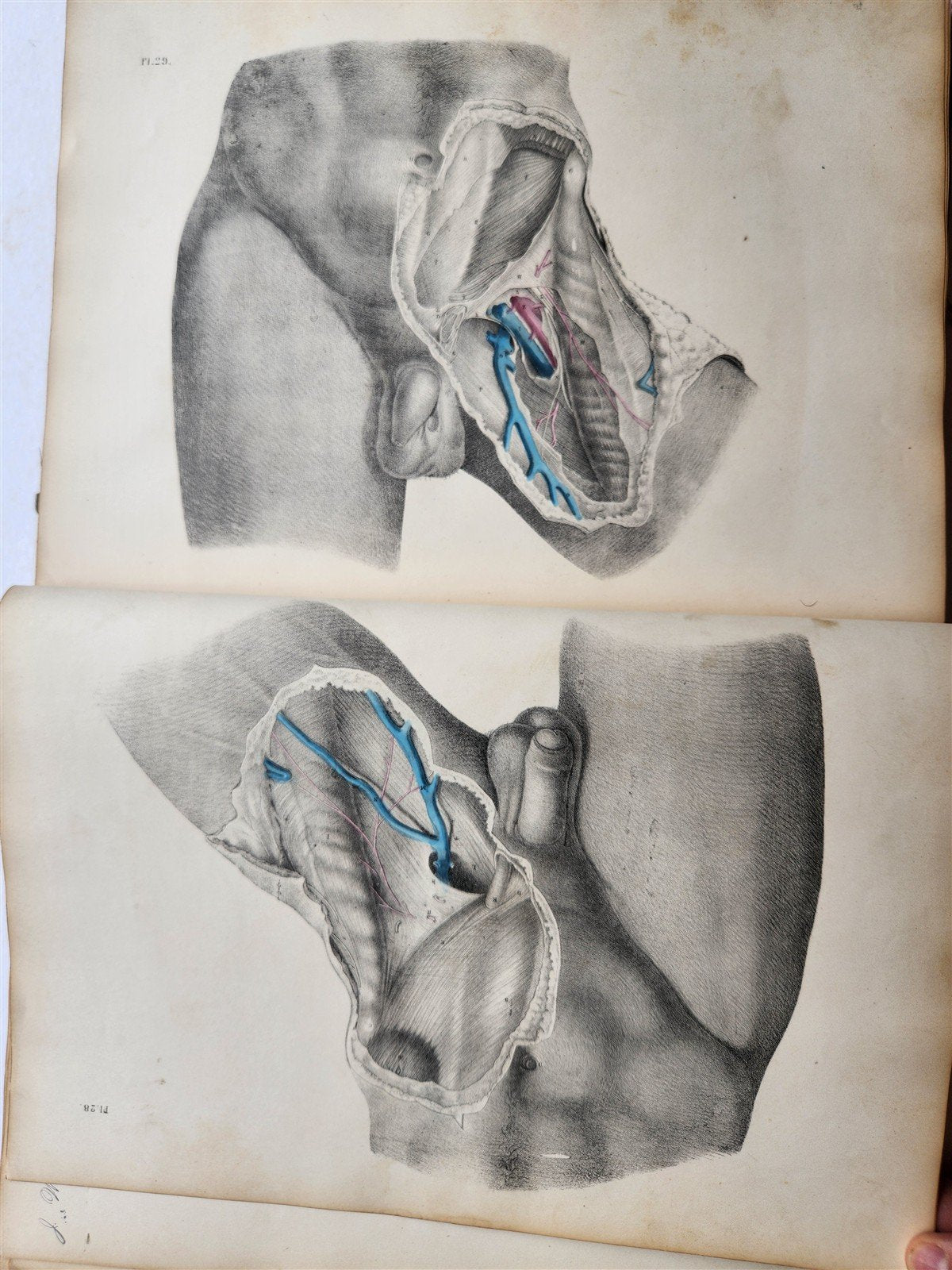 1860s SURGICAL ANATOMY by Joseph Maclise antique ILLUSTRATED w/ 68 plates