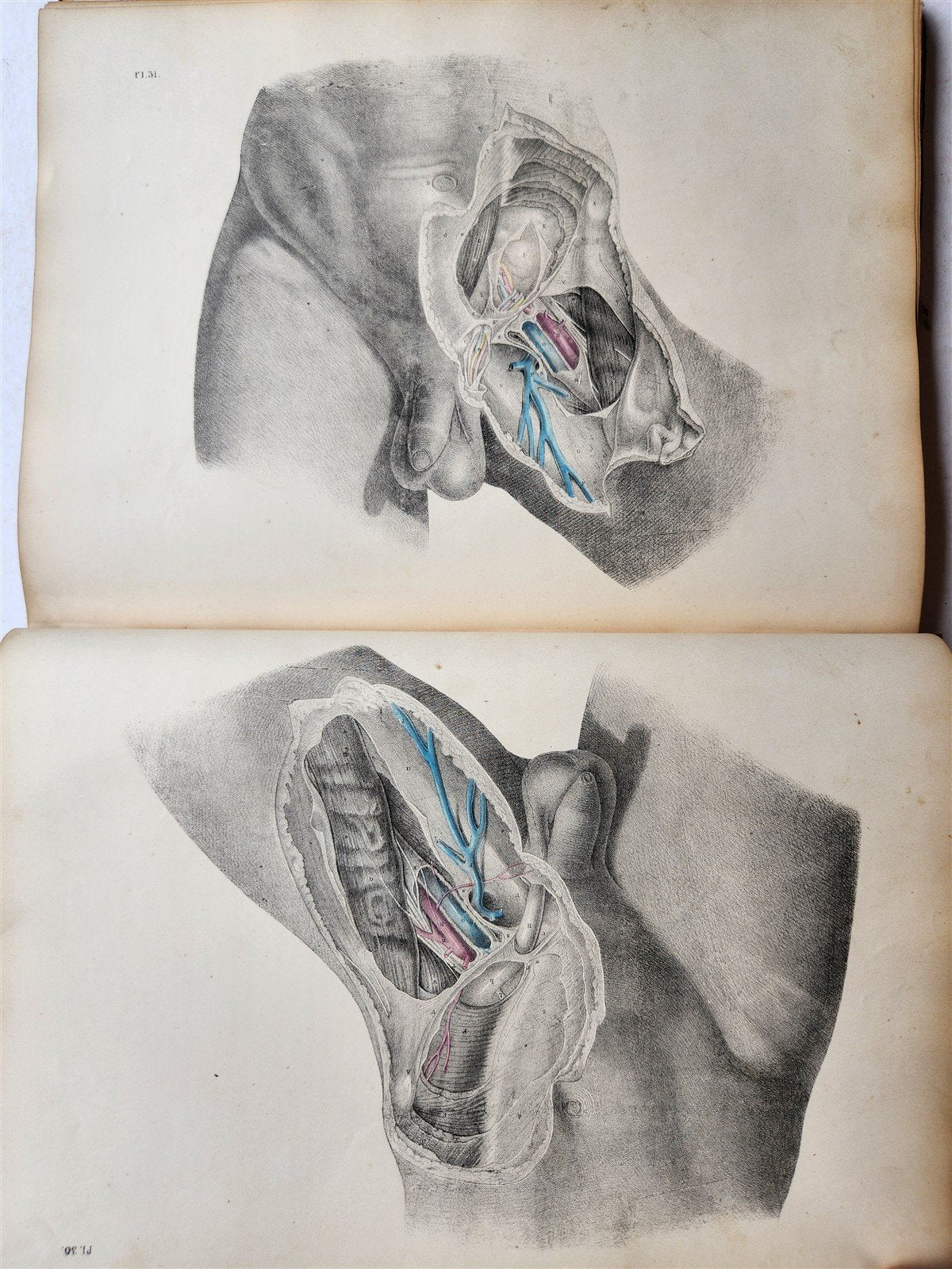 1860s SURGICAL ANATOMY by Joseph Maclise antique ILLUSTRATED w/ 68 plates