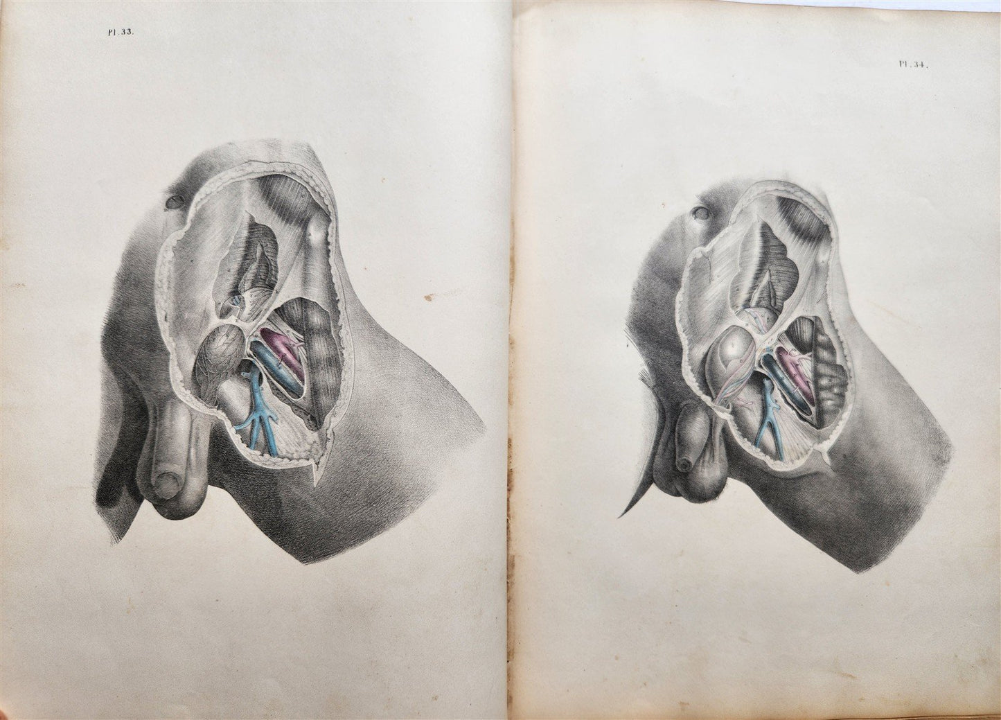 1860s SURGICAL ANATOMY by Joseph Maclise antique ILLUSTRATED w/ 68 plates