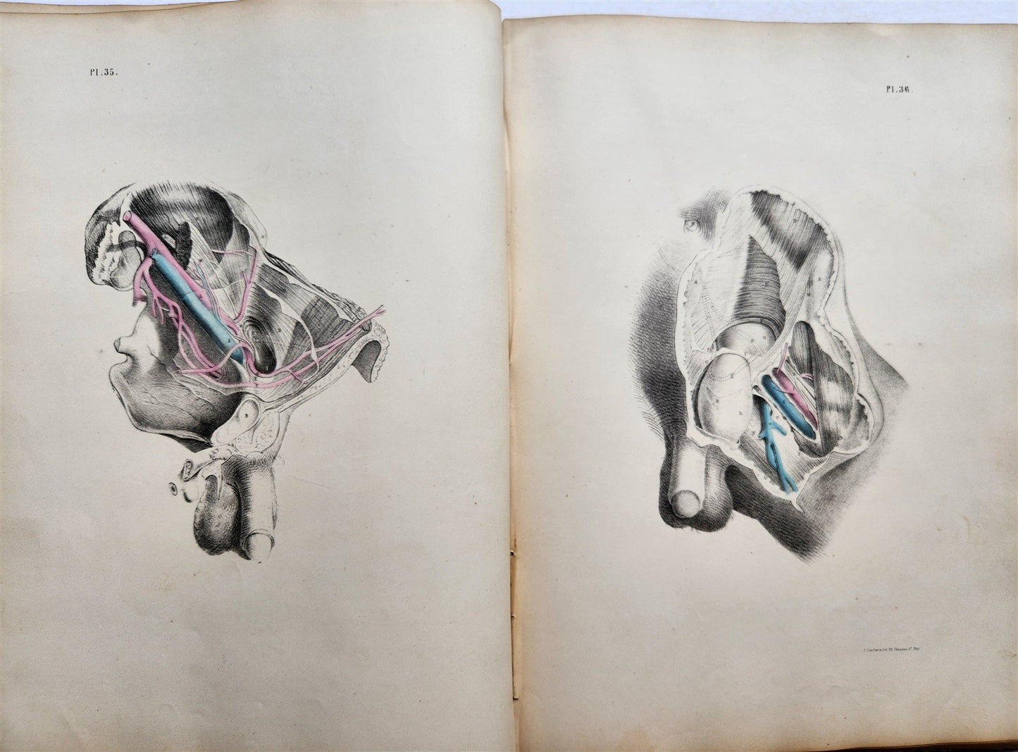 1860s SURGICAL ANATOMY by Joseph Maclise antique ILLUSTRATED w/ 68 plates