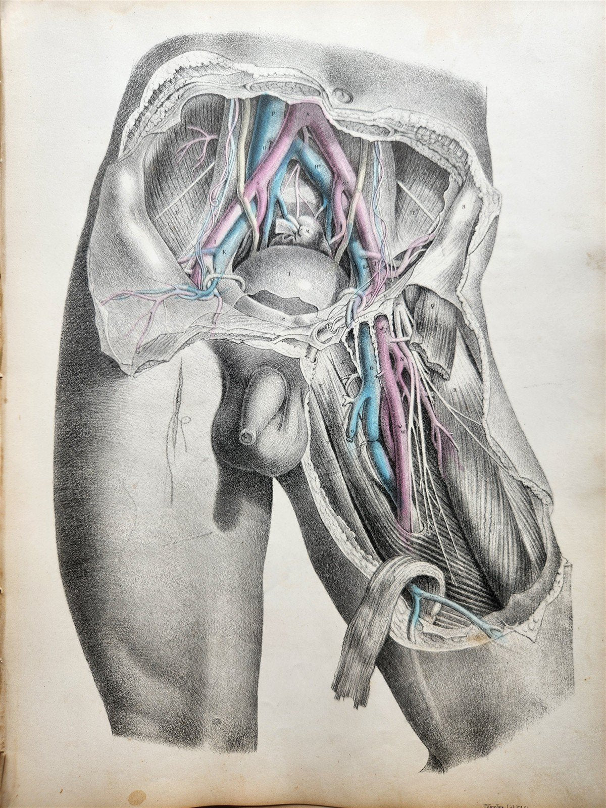1860s SURGICAL ANATOMY by Joseph Maclise antique ILLUSTRATED w/ 68 plates