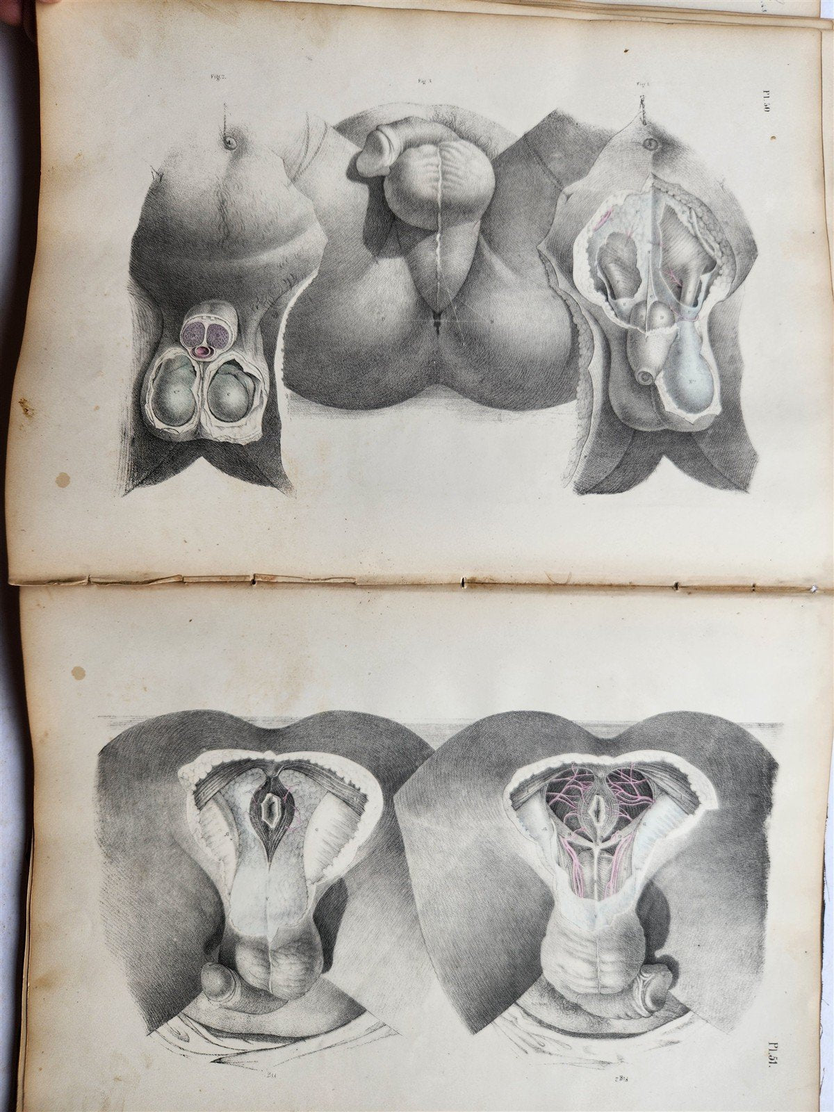 1860s SURGICAL ANATOMY by Joseph Maclise antique ILLUSTRATED w/ 68 plates
