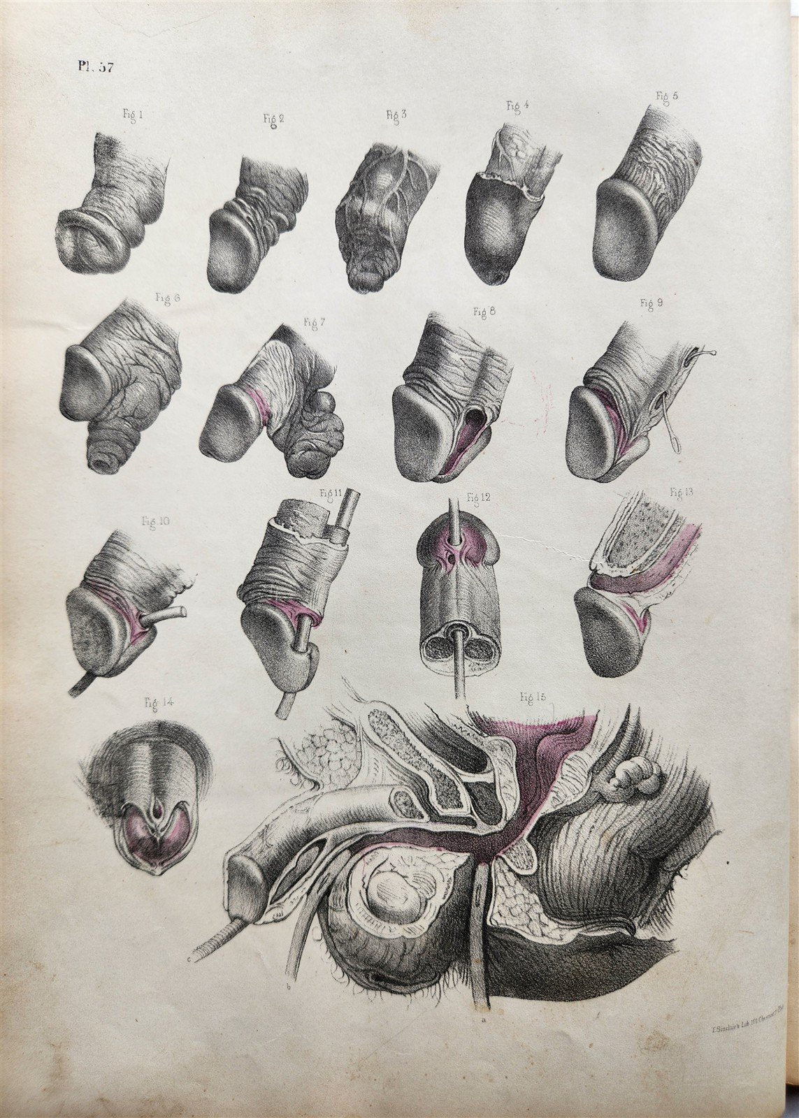 1860s SURGICAL ANATOMY by Joseph Maclise antique ILLUSTRATED w/ 68 plates