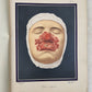 1895 PICTORIAL ATLAS of SKIN DISEASES & SYPHILITIC AFFECTION antique ILLUSTRATED