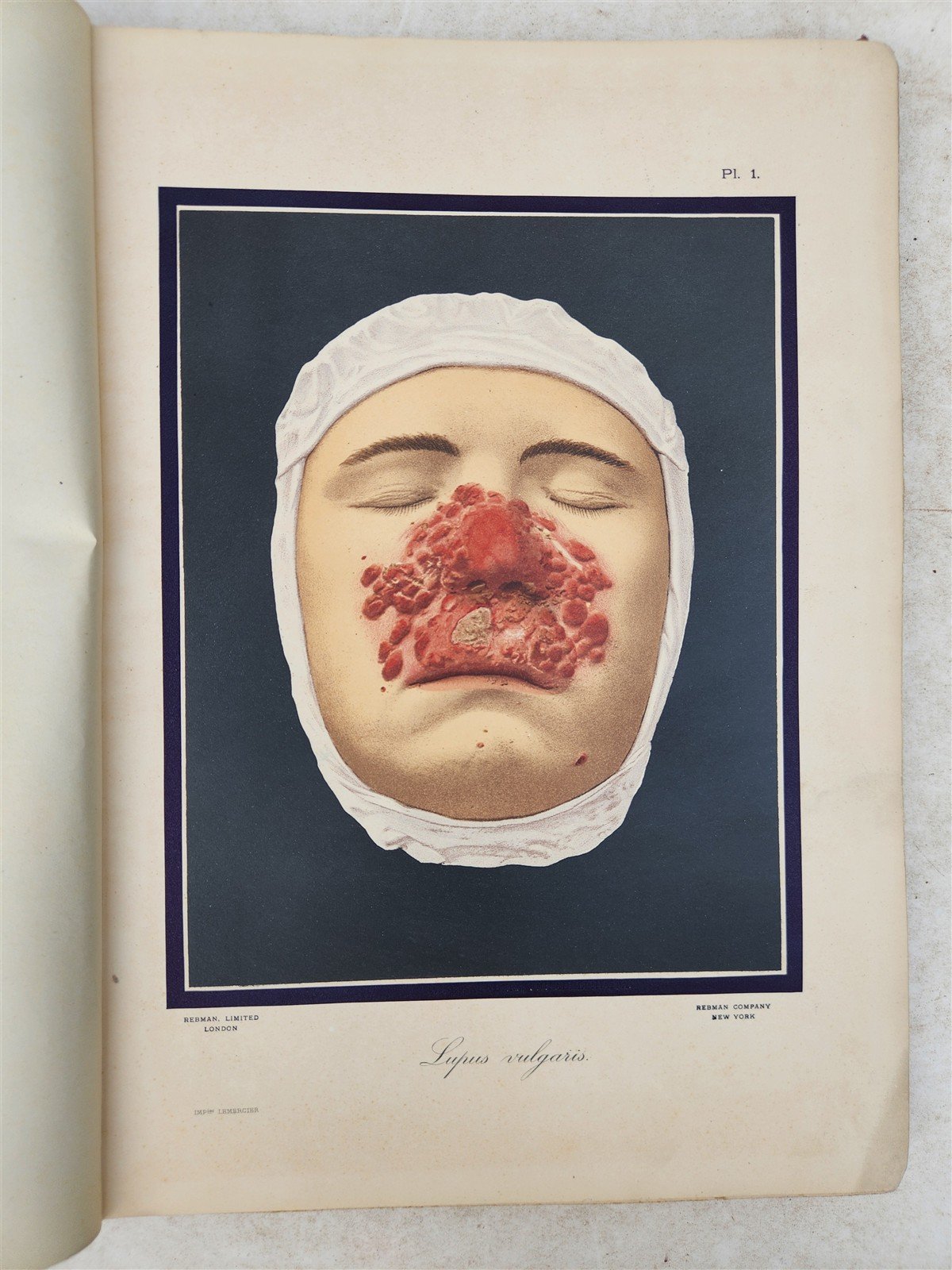 1895 PICTORIAL ATLAS of SKIN DISEASES & SYPHILITIC AFFECTION antique ILLUSTRATED