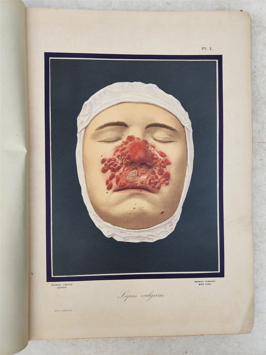 1895 PICTORIAL ATLAS of SKIN DISEASES & SYPHILITIC AFFECTION antique ILLUSTRATED