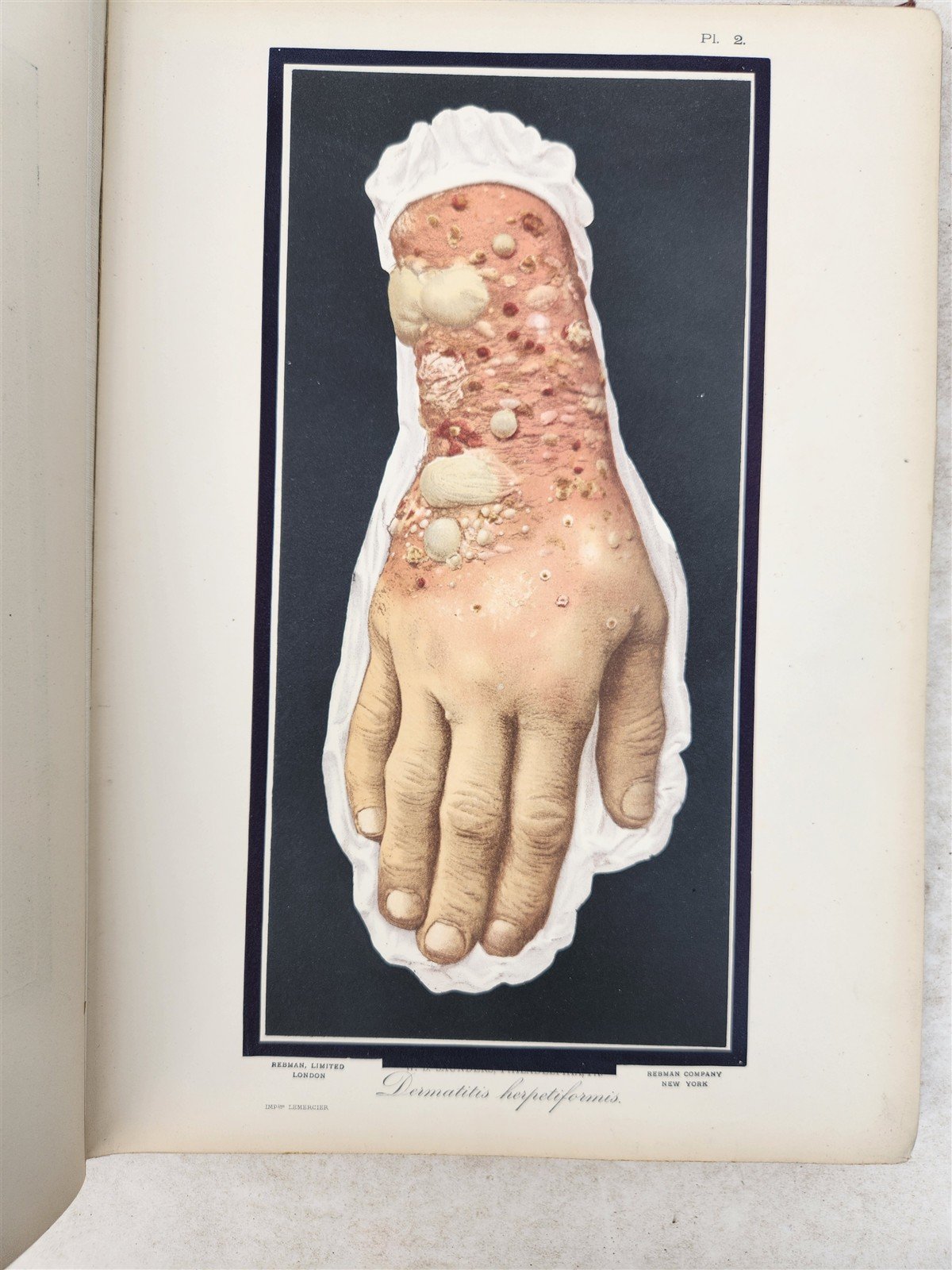 1895 PICTORIAL ATLAS of SKIN DISEASES & SYPHILITIC AFFECTION antique ILLUSTRATED
