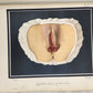 1895 PICTORIAL ATLAS of SKIN DISEASES & SYPHILITIC AFFECTION antique ILLUSTRATED