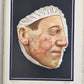 1895 PICTORIAL ATLAS of SKIN DISEASES & SYPHILITIC AFFECTION antique ILLUSTRATED