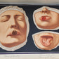 1895 PICTORIAL ATLAS of SKIN DISEASES & SYPHILITIC AFFECTION antique ILLUSTRATED