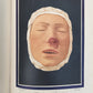 1895 PICTORIAL ATLAS of SKIN DISEASES & SYPHILITIC AFFECTION antique ILLUSTRATED